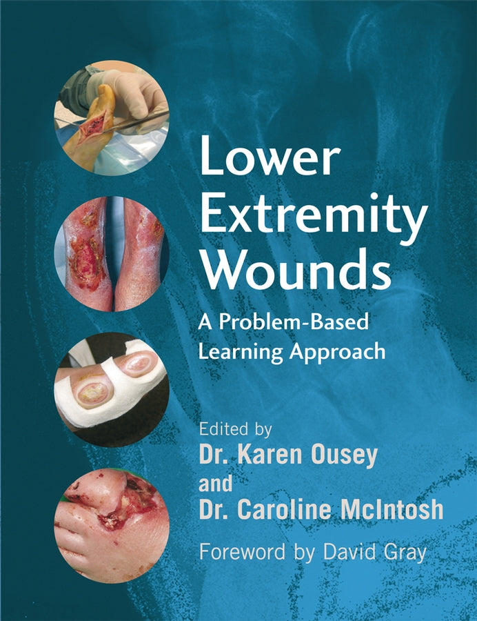 Lower Extremity Wounds; A Problem-Based Approach (Paperback / softback) 9780470059081