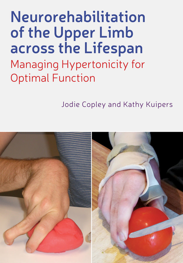 Neurorehabilitation of the Upper Limb Across the Lifespan; Managing Hypertonicity for Optimal Function (Paperback / softback) 9780470670316