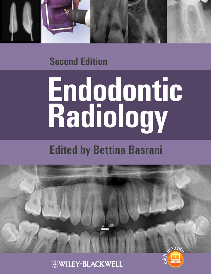 Endodontic Radiology (Hardback) 9780470958490