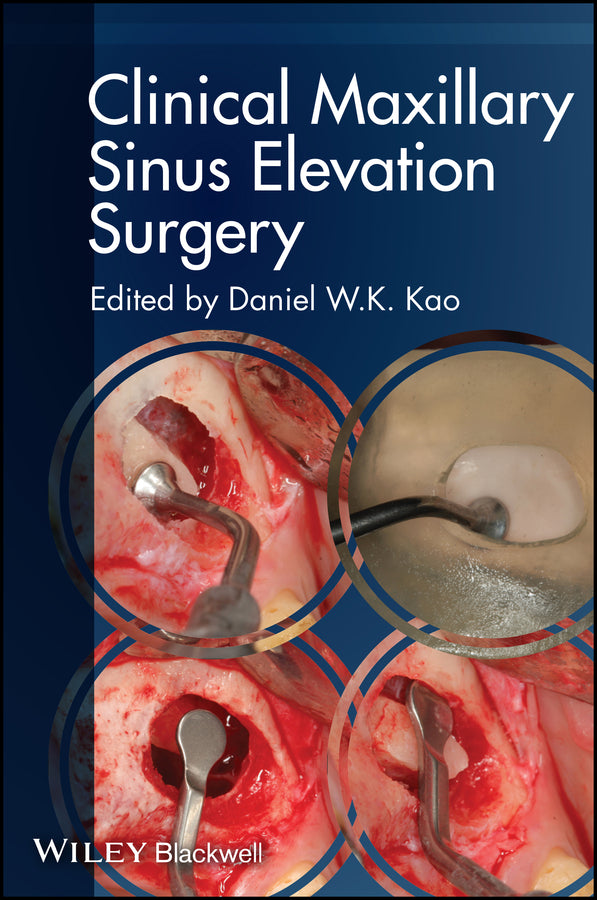 Clinical Maxillary Sinus Elevation Surgery (Paperback / softback) 9780470960738