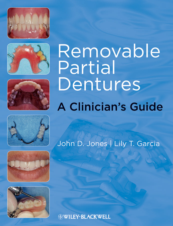 Removable Partial Dentures; A Clinician's Guide (Paperback / softback) 9780813817064