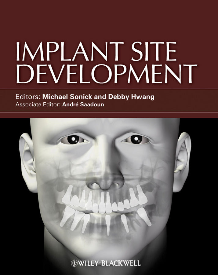Implant Site Development (Hardback) 9780813825120