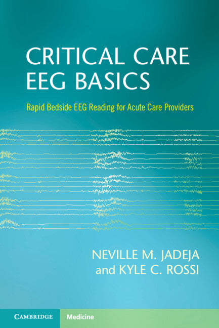 Critical Care EEG Basics; Rapid Bedside EEG Reading for Acute Care Providers (Paperback / softback) 9781009261166
