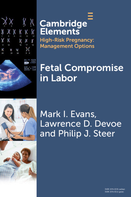 Fetal Compromise in Labor (Paperback / softback) 9781009466301