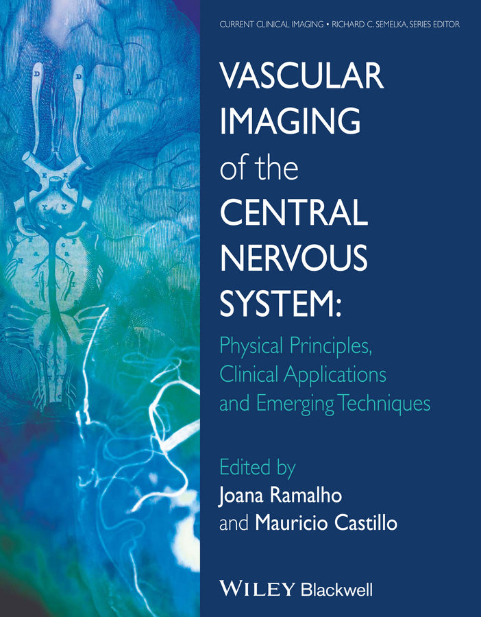 Vascular Imaging of the Central Nervous System; Physical Principles, Clinical Applications, and Emerging Techniques (Hardback) 9781118188750
