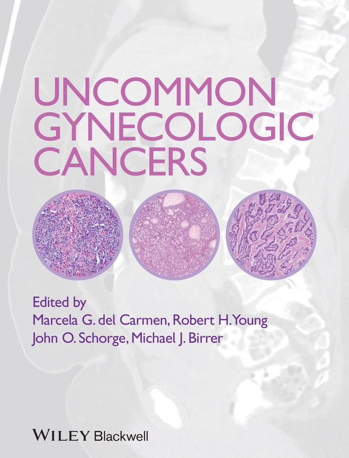 Uncommon Gynecologic Cancers (Hardback) 9781118655351