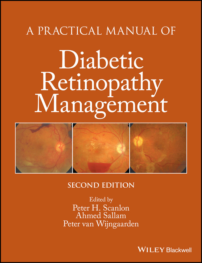 A Practical Manual of Diabetic Retinopathy Management (Hardback) 9781119058953