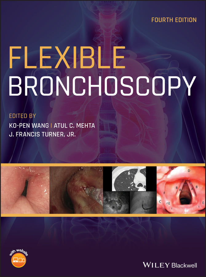 Flexible Bronchoscopy (Hardback) 9781119389057