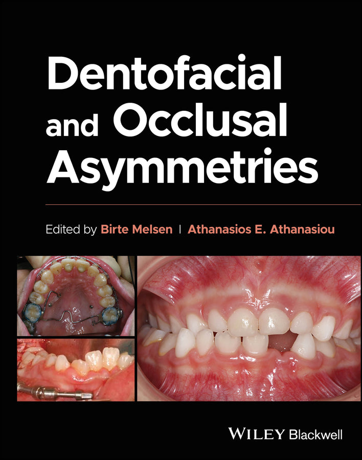 Dentofacial and Occlusal Asymmetries (Hardback) 9781119794813