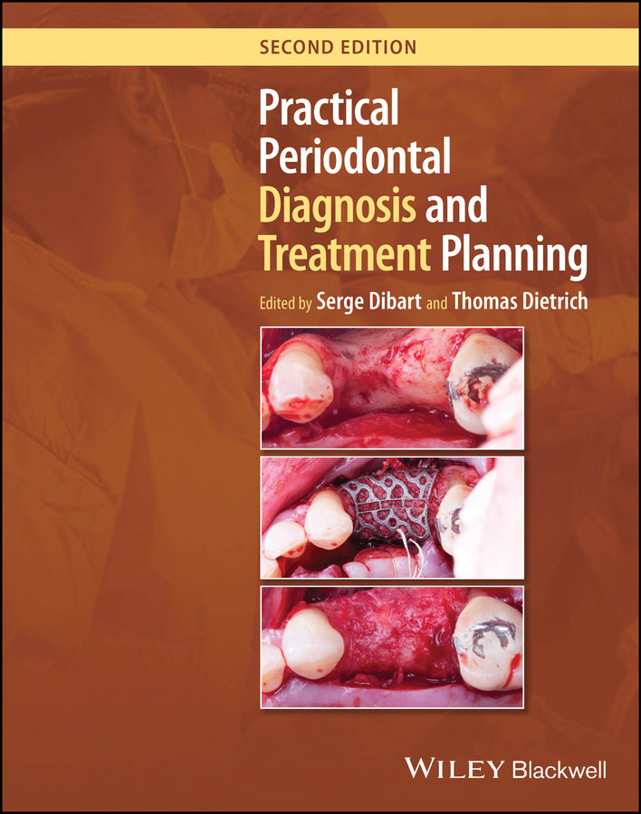 Practical Periodontal Diagnosis and Treatment Planning (Hardback) 9781119830313