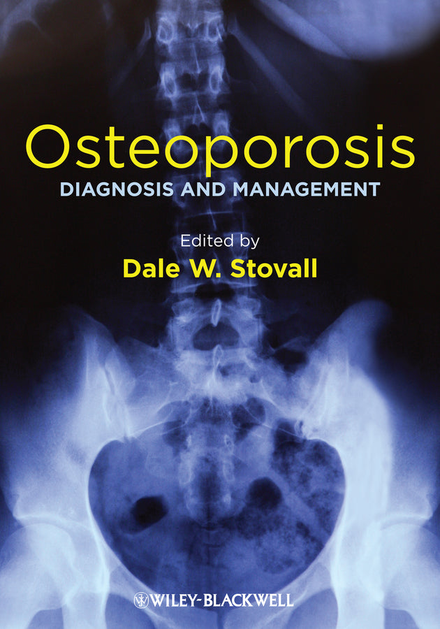 Osteoporosis; Diagnosis and Management (Hardback) 9781119968917