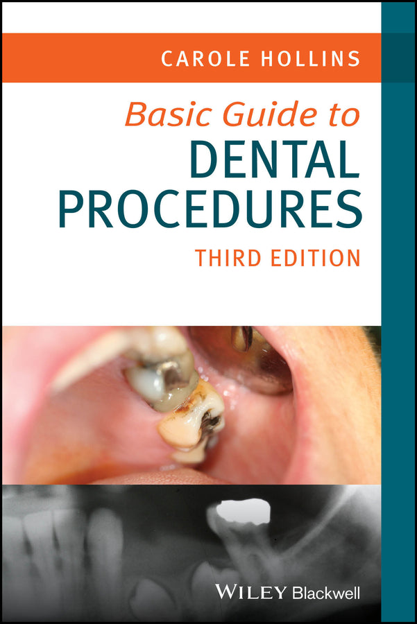 Basic Guide to Dental Procedures (Paperback / softback) 9781394187874