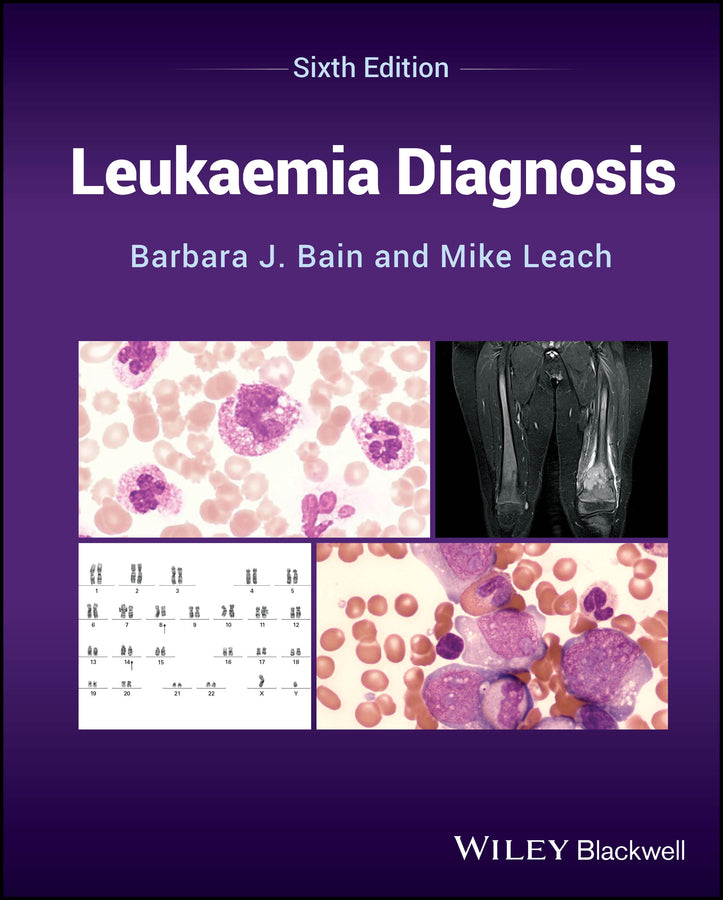 Leukaemia Diagnosis (Hardback) 9781394218585