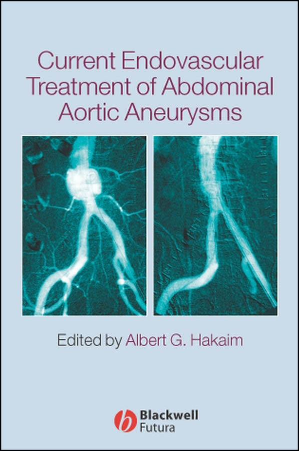 Current Endovascular Treatment of Abdominal Aortic Aneurysms (Hardback) 9781405122054