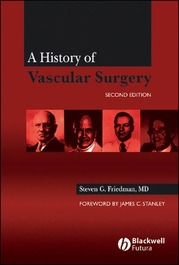 A History of Vascular Surgery (Hardback) 9781405125222