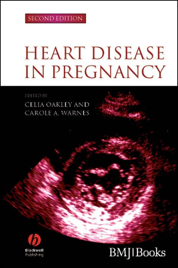 Heart Disease in Pregnancy (Hardback) 9781405134880