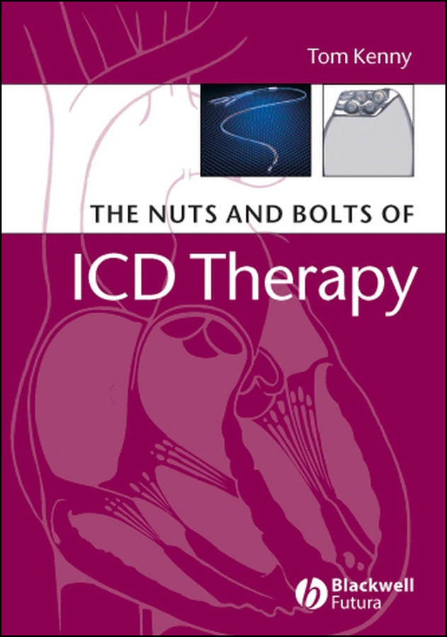 The Nuts and Bolts of ICD Therapy (Paperback / softback) 9781405135115
