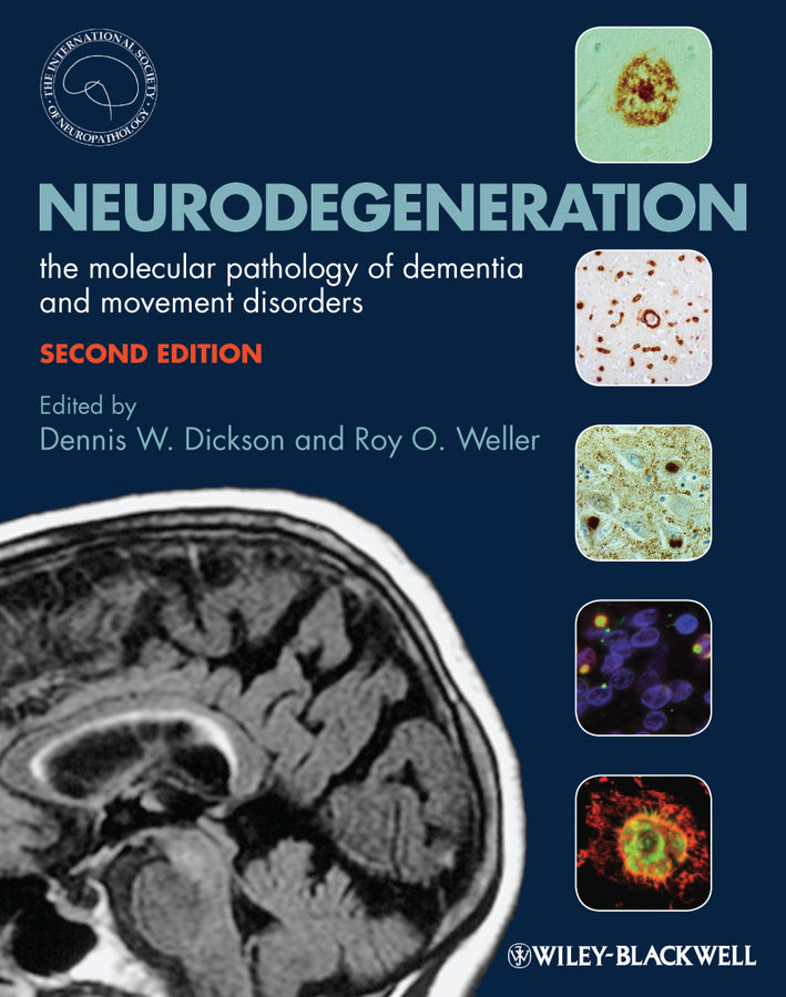 Neurodegeneration; The Molecular Pathology of Dementia and Movement Disorders (Hardback) 9781405196932