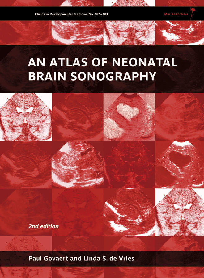 An Atlas of Neonatal Brain Sonography (Hardback) 9781898683568