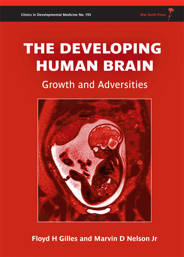 The Developing Human Brain; Growth and Adversities (Hardback) 9781908316417