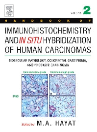 Handbook of Immunohistochemistry and in Situ Hybridization of Human Carcinomas; Molecular Pathology, Colorectal Carcinoma, and Prostate Carcinoma (Hardback) 9780123339423