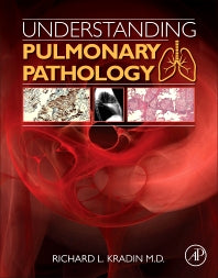 Understanding Pulmonary Pathology; Applying Pathological Findings in Therapeutic Decision Making (Paperback) 9780128013045