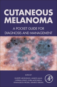 Cutaneous Melanoma; A Pocket Guide for Diagnosis and Management (Paperback) 9780128040003