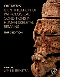 Ortner's Identification of Pathological Conditions in Human Skeletal Remains (Hardback) 9780128097380