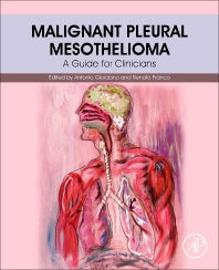 Malignant Pleural Mesothelioma; A Guide for Clinicians (Paperback) 9780128127247
