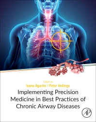 Implementing Precision Medicine in Best Practices of Chronic Airway Diseases (Paperback) 9780128134719