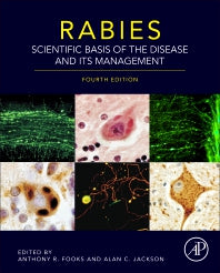 Rabies; Scientific Basis of the Disease and Its Management (Hardback) 9780128187050