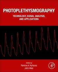 Photoplethysmography; Technology, Signal Analysis and Applications (Paperback) 9780128233740