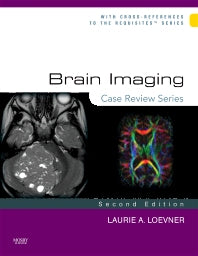 Brain Imaging: Case Review Series (Hardback) 9780323031790