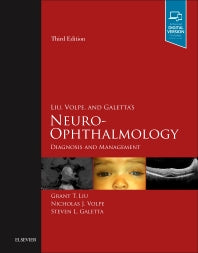 Liu, Volpe, and Galetta’s Neuro-Ophthalmology; Diagnosis and Management (Hardback) 9780323340441