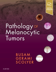 Pathology of Melanocytic Tumors (Hardback) 9780323374576