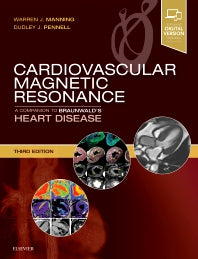 Cardiovascular Magnetic Resonance; A Companion to Braunwald’s Heart Disease (Hardback) 9780323415613