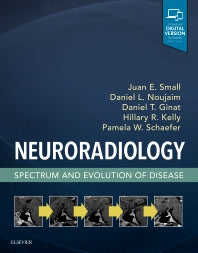 Neuroradiology: Spectrum and Evolution of Disease (Hardback) 9780323445498