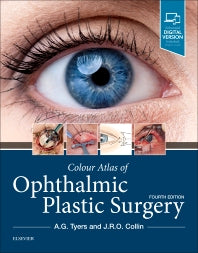 Colour Atlas of Ophthalmic Plastic Surgery (Hardback) 9780323476799