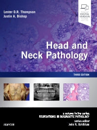 Head and Neck Pathology; A Volume in the Series: Foundations in Diagnostic Pathology (Hardback) 9780323479165
