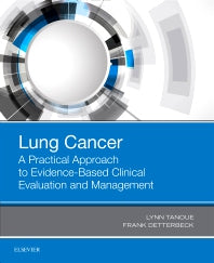 Lung Cancer: A Practical Approach to Evidence-Based Clinical Evaluation and Management (Paperback / softback) 9780323485654