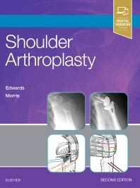 Shoulder Arthroplasty (Hardback) 9780323529402