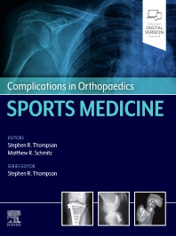 Complications in Orthopaedics: Sports Medicine (Hardback) 9780323545983