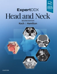 ExpertDDX: Head and Neck (Hardback) 9780323554053