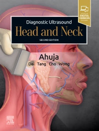 Diagnostic Ultrasound: Head and Neck (Hardback) 9780323625722