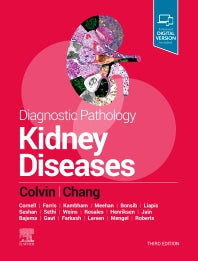 Diagnostic Pathology: Kidney Diseases (Hardback) 9780323661089