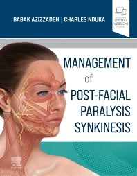 Management of Post-Facial Paralysis Synkinesis (Hardback) 9780323673310