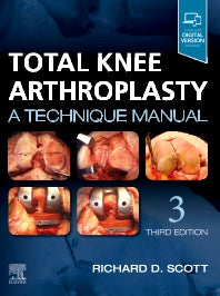 Total Knee Arthroplasty; A Technique Manual (Hardback) 9780323710657