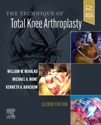 The Technique of Total Knee Arthroplasty (Hardback) 9780323713023
