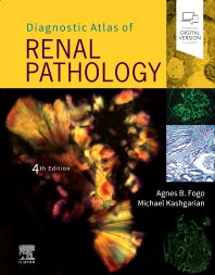 Diagnostic Atlas of Renal Pathology (Hardback) 9780323721639