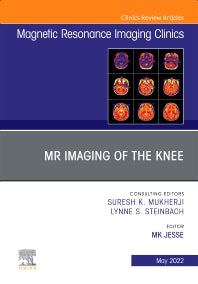 MR Imaging of The Knee, An Issue of Magnetic Resonance Imaging Clinics of North America (Hardback) 9780323813853
